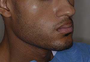 Patient After