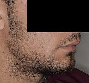 Patient Before