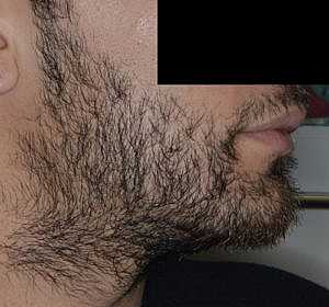 Patient After