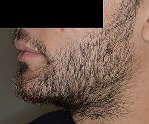 Patient After