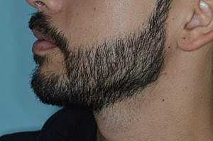 Patient After