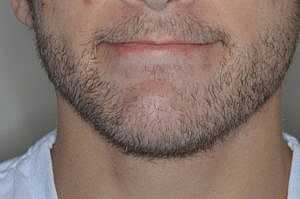 Patient After