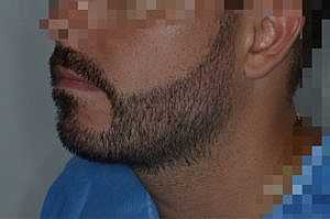 Patient After