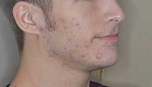 Patient Before
