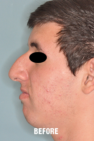 Patient Before