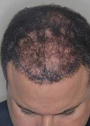 Patient Before