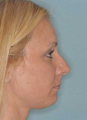 Patient Before