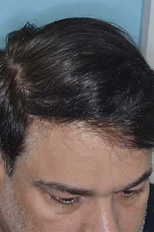 Patient After
