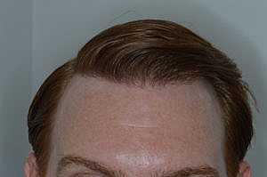 Patient After