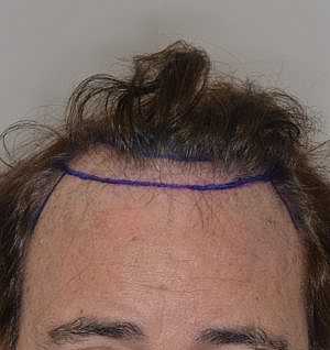 Patient Before