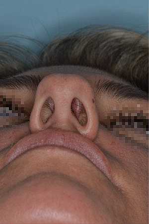 Patient Before