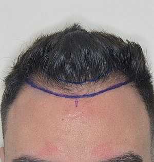 Patient Before
