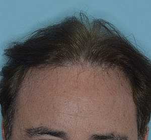 Patient After