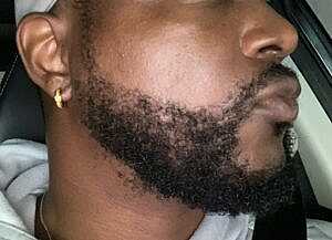 Patient After