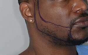 Patient Before