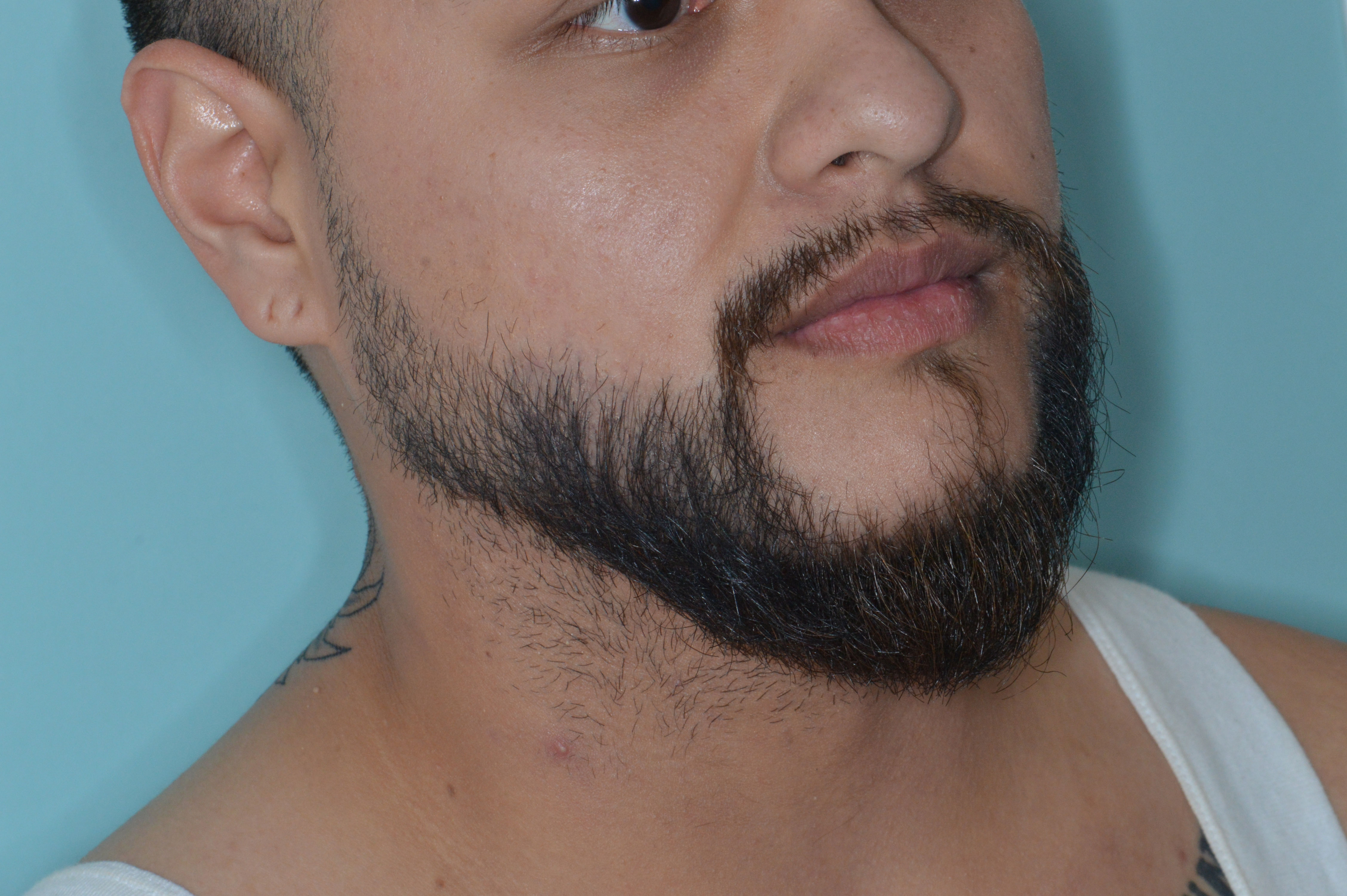 Patient After
