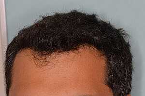 Patient After